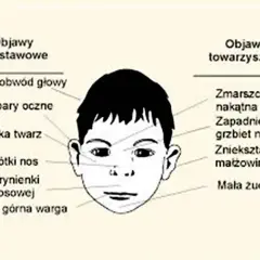 Jak wygląda dziecko z FAS? Poznaj charakterystyczne cechy i objawy